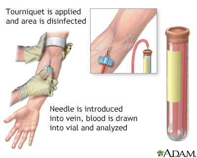 Blood test Blood test