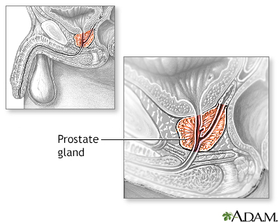 Prostate gland Prostate gland