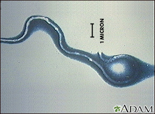 Lyme disease organism, Borrelia burgdorferi Lyme disease organism, Borrelia burgdorferi