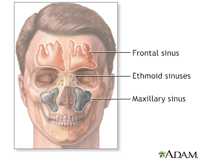 Sinuses Sinuses