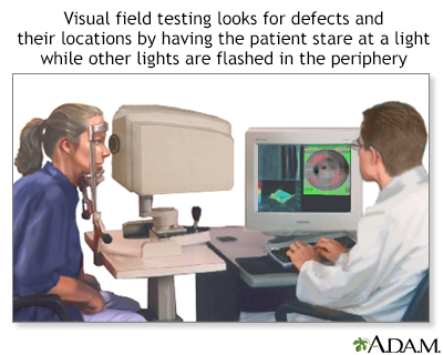 Visual field test Visual field test