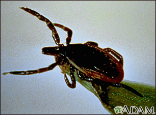 Tick, deer - adult female Tick, deer - adult female