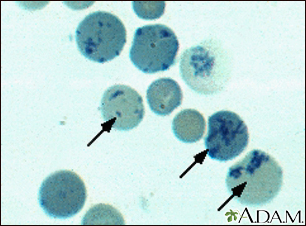 Reticulocytes Reticulocytes