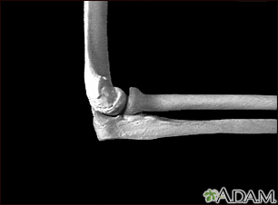 Elbow - side view Elbow - side view