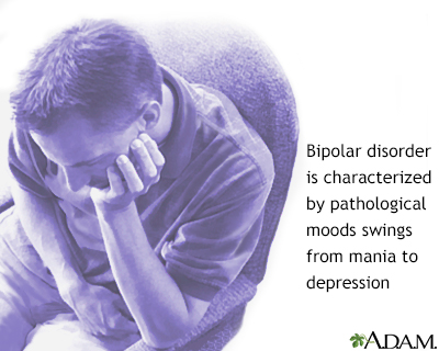 Bipolar disorder Bipolar disorder