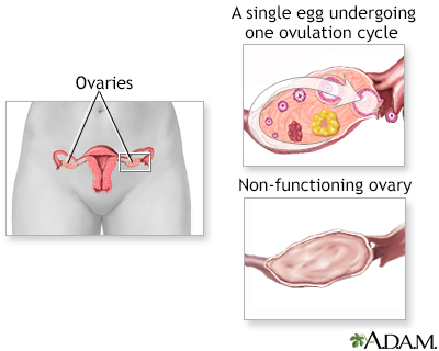 Infertility Factors Infertility Factors