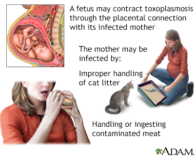 Taxoplasmosis Taxoplasmosis
