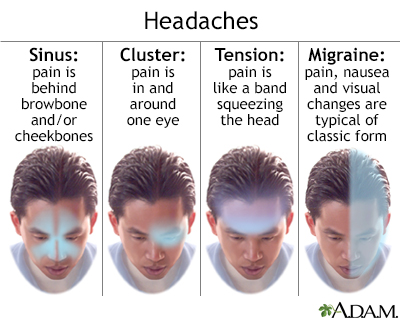 Headache Headache