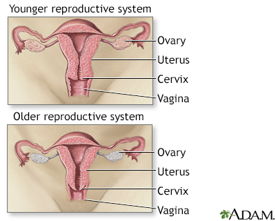 Menopause Menopause