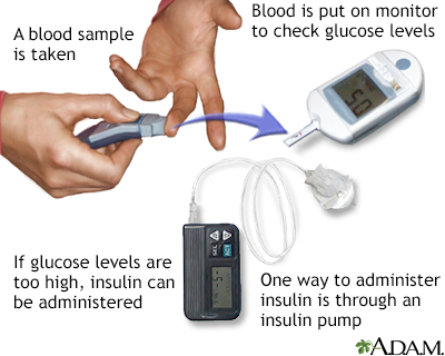 Glucose test Glucose test