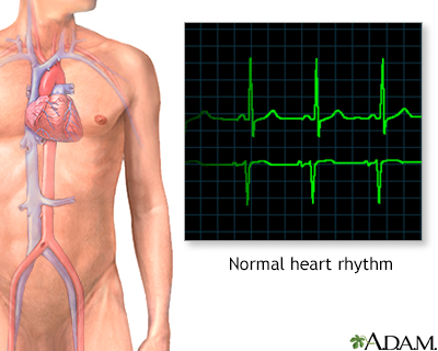 Normal heart rhythm Normal heart rhythm