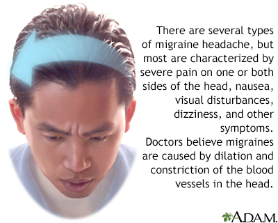 Migraine headache Migraine headache