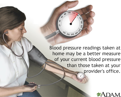 Monitoring blood pressure Monitoring blood pressure