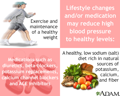 Lifestyle changes Lifestyle changes