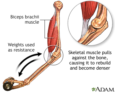 Bone-building exercise Bone-building exercise