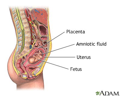Amniocentesis Amniocentesis