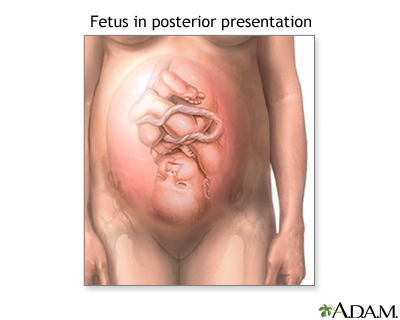 Posterior Presentation Posterior Presentation