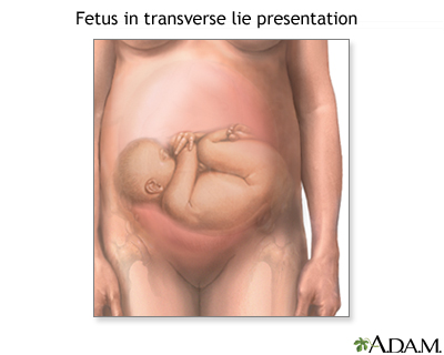 Transverse Lie Transverse Lie