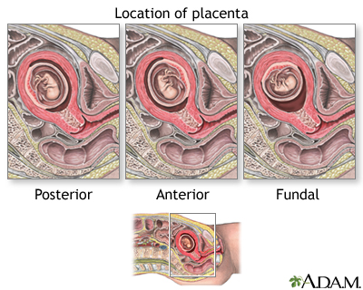 Chorionic Villus Sampling Chorionic Villus Sampling