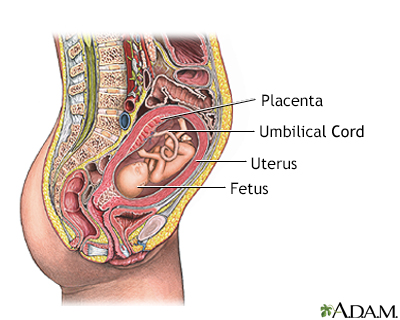 Percutaneous Umbilical Cord Sampling 1 Percutaneous Umbilical Cord Sampling 1