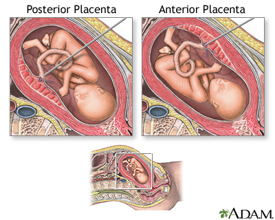 Percutaneous Umbilical Cord Sampling 3 Percutaneous Umbilical Cord Sampling 3