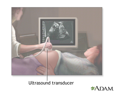 Ultrasound 1 Ultrasound 1