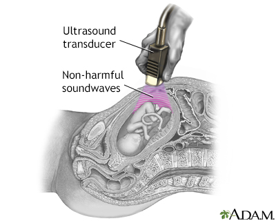 Ultrasound 2 Ultrasound 2