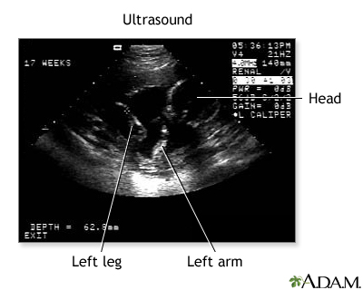 Ultrasound 3 Ultrasound 3