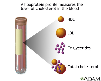 Cholesterol screening Cholesterol screening