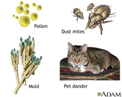 Common asthma triggers Common asthma triggers