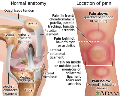 Knee pain Knee pain