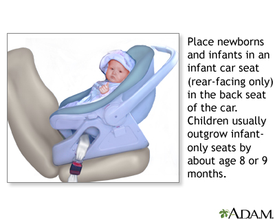 Rear-facing car seat Rear-facing car seat