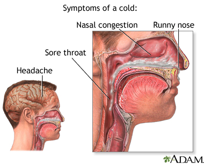 Cold symptoms Cold symptoms