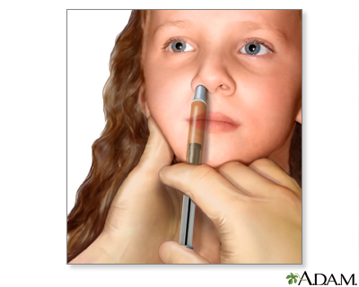 Nasal spray flu vaccine Nasal spray flu vaccine