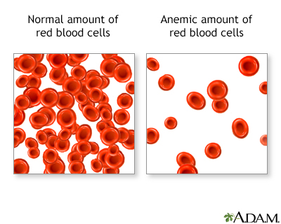 Red Blood Cells and Anemia Red Blood Cells and Anemia