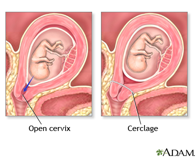 Cervix Cervix