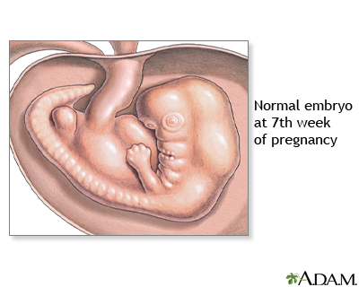 7 Week Old Fetus 7 Week Old Fetus