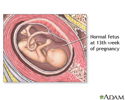 13 Week Old Fetus 13 Week Old Fetus