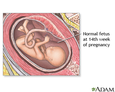14 Week Old Fetus 14 Week Old Fetus