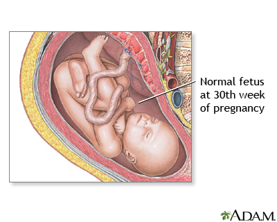 30 Week Old Fetus 30 Week Old Fetus