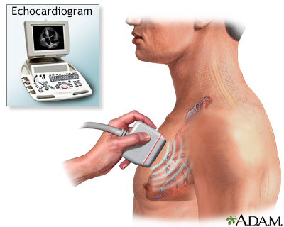 Echocardiogram Echocardiogram