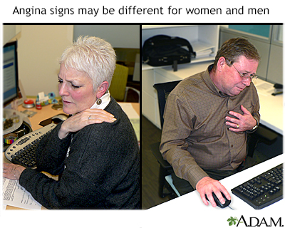 Angina Angina