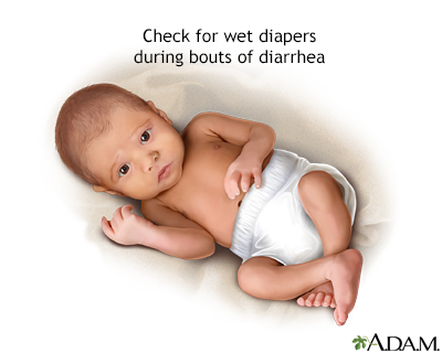 Diapers and diarrhea Diapers and diarrhea