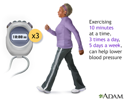 Exercise can lower blood pressure Exercise can lower blood pressure