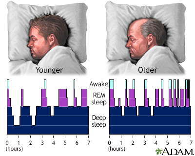 Sleep patterns in the young and aged Sleep patterns in the young and aged