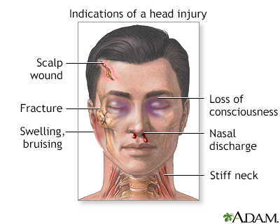 Indications of head injury Indications of head injury