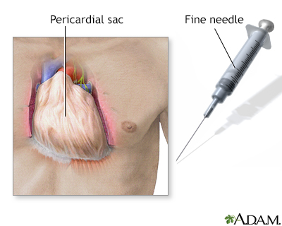 Pericardium Pericardium