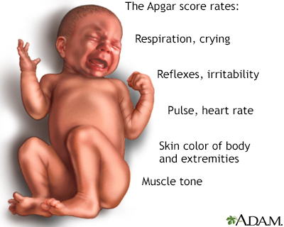Apgar Scores Apgar Scores