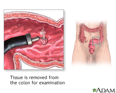 Colon culture Colon culture
