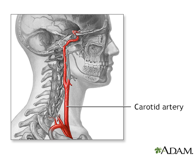 Carotid artery anatomy Carotid artery anatomy